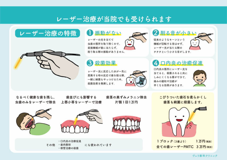 歯周治療・インプラント治療におけるEr:YAGレーザーの使い シエン社 | 歯周治療・インプラント治療におけるEr：YAGレーザーの使い方