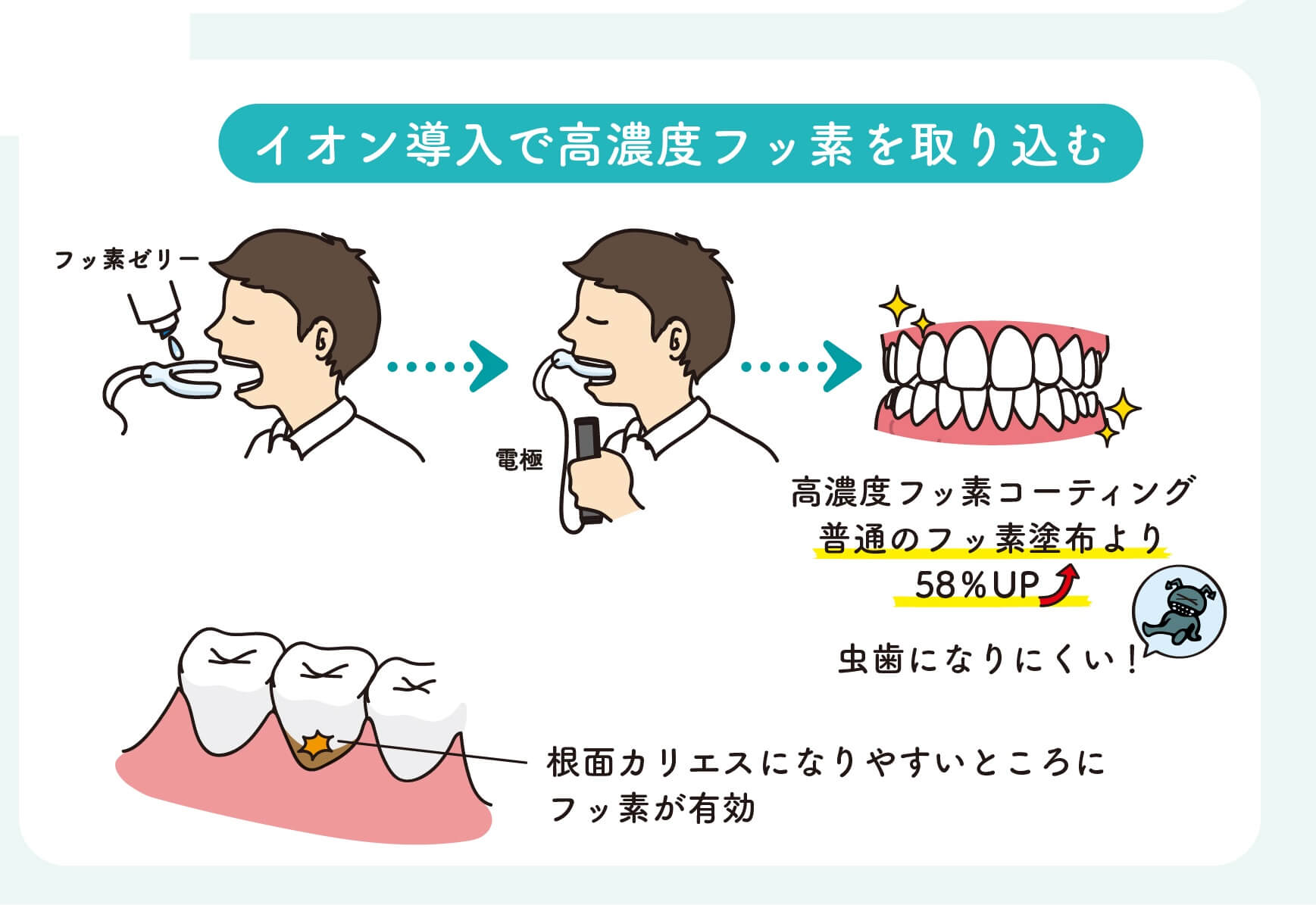 フッ 酸 歯医者