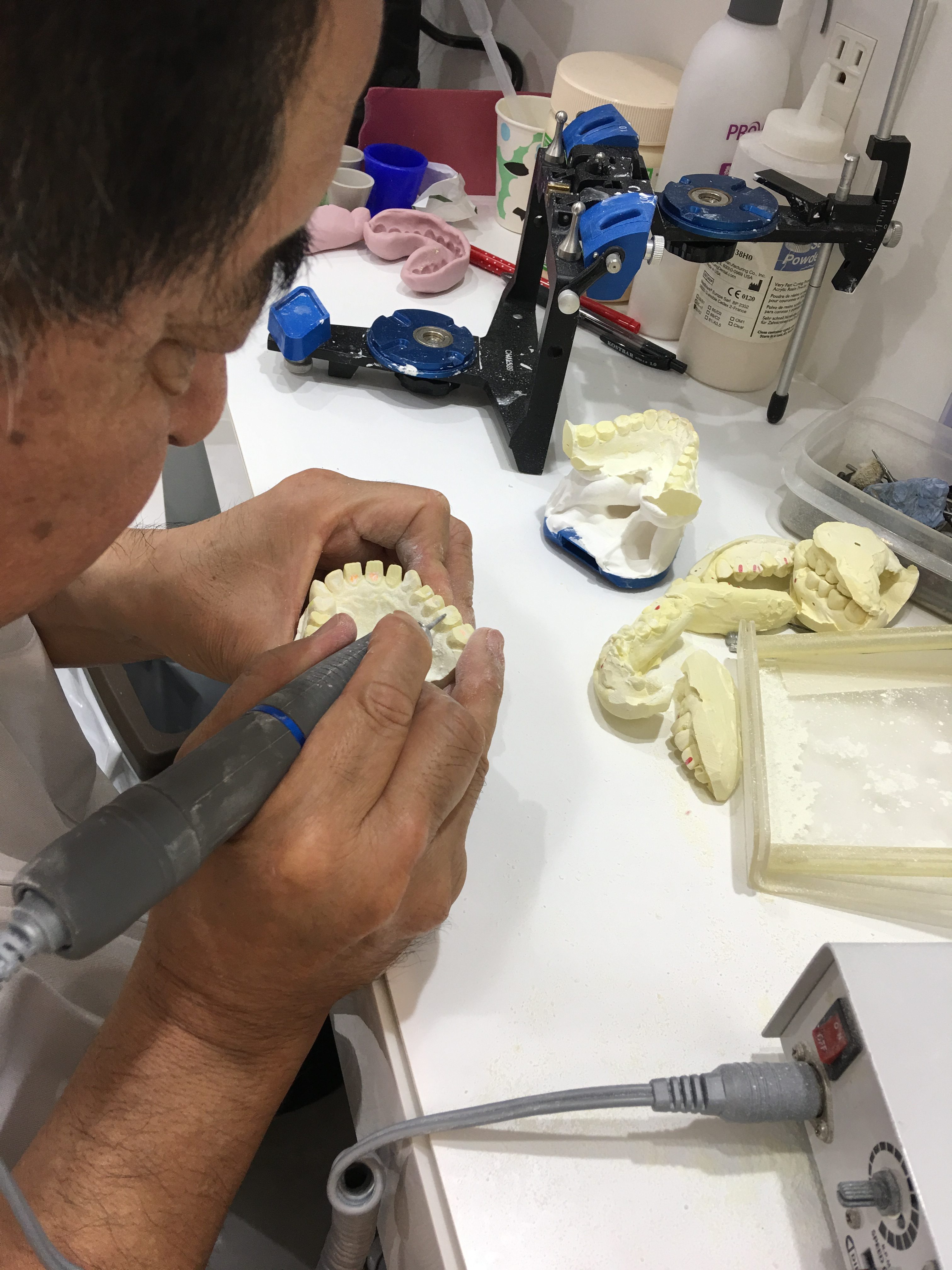 院内技工士さんによる仮歯の製作