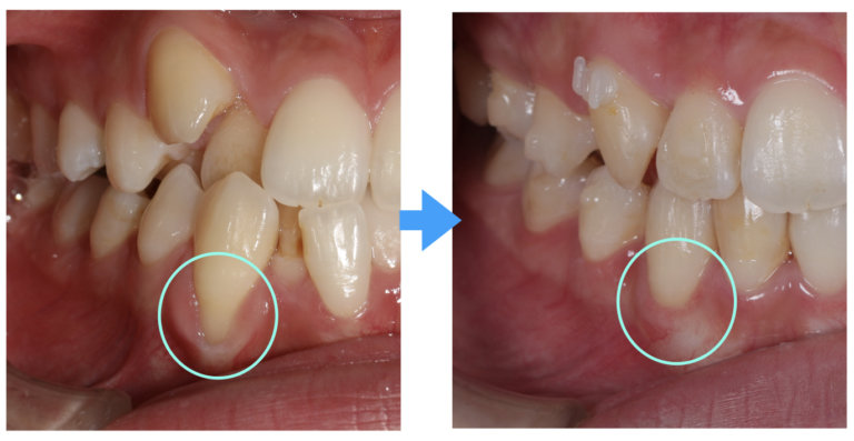 8. オメガ3脂肪酸